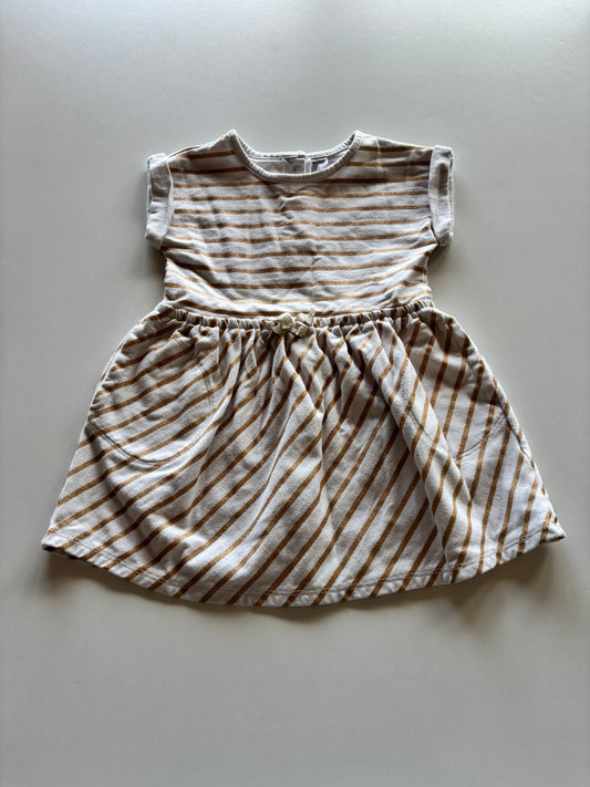 Sparkly Gold Striped Dress
